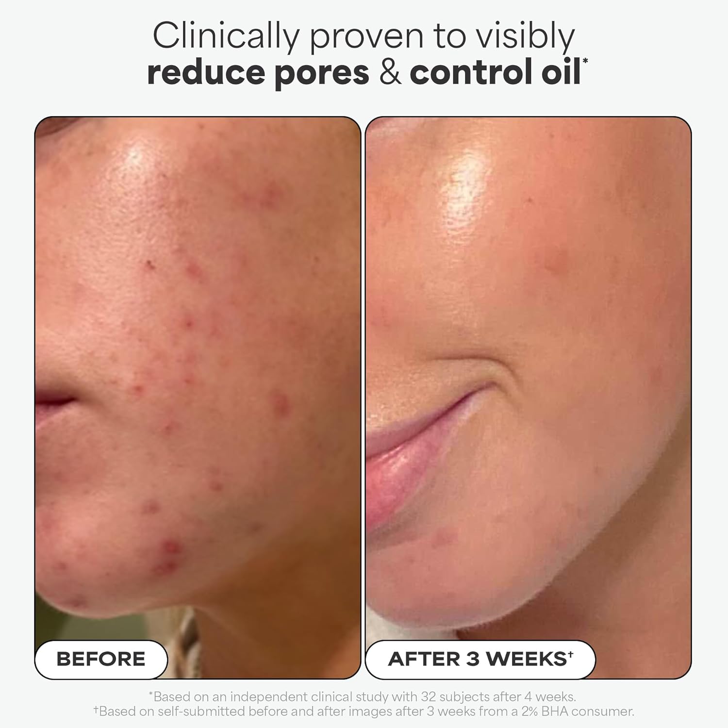 ClearBoost BHA Exfoliant